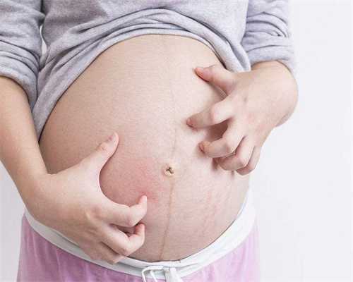 试管植入后可以吃糯米糍粑吗有影响吗孕妇